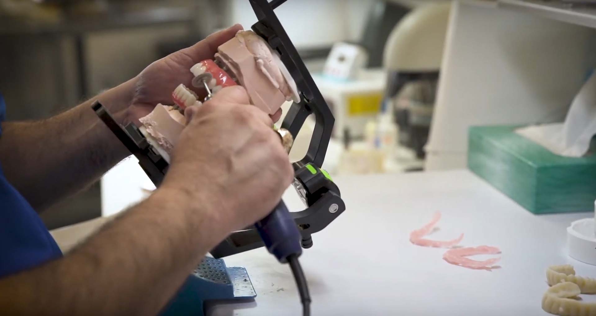 In-house laboratory work on an implant restoration at Implants 4 Life